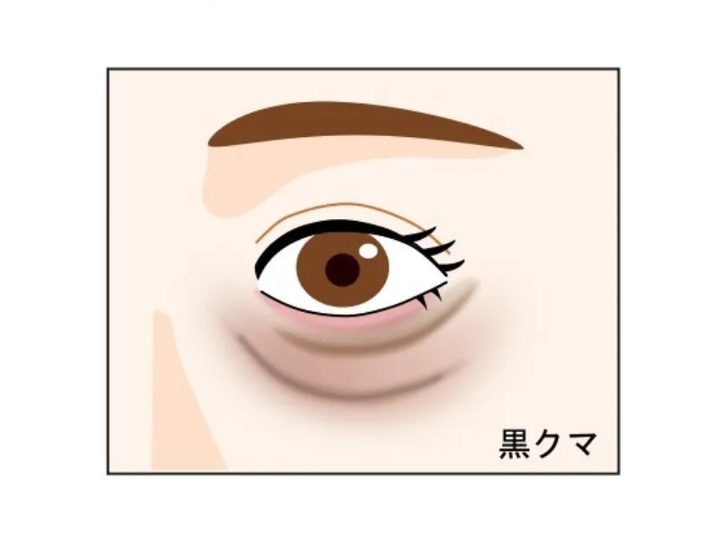 黒クマ（影クマ）