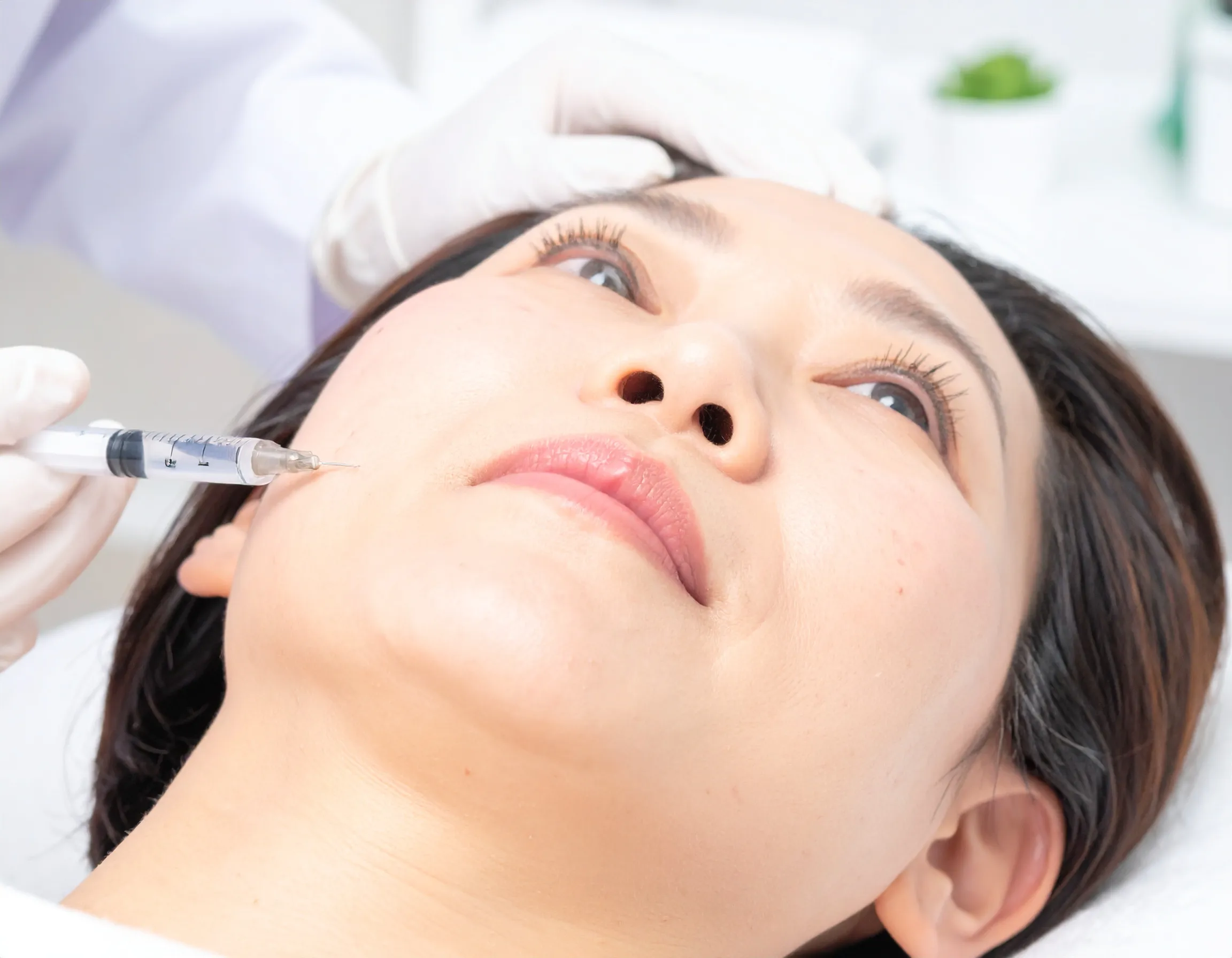 咬筋（エラ）のボトックス