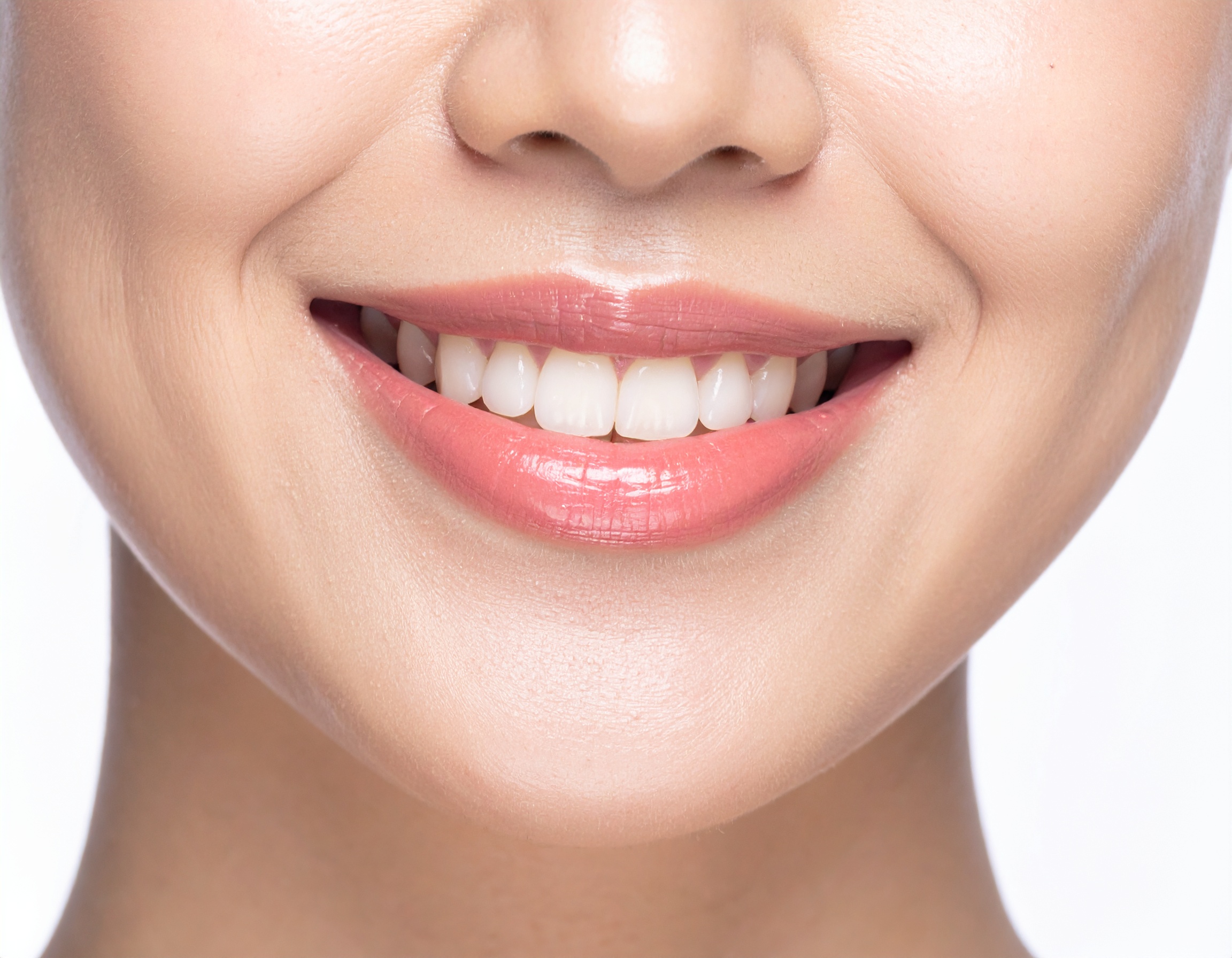 顎ヒアルロン（施術前）